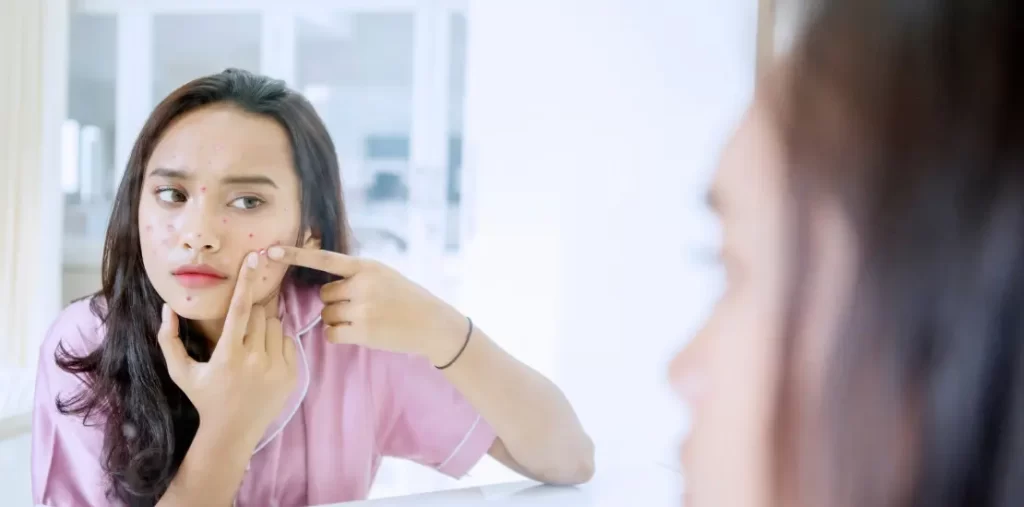 Wanita muda sedang melihat cermin dan menekan jerawat di pipinya