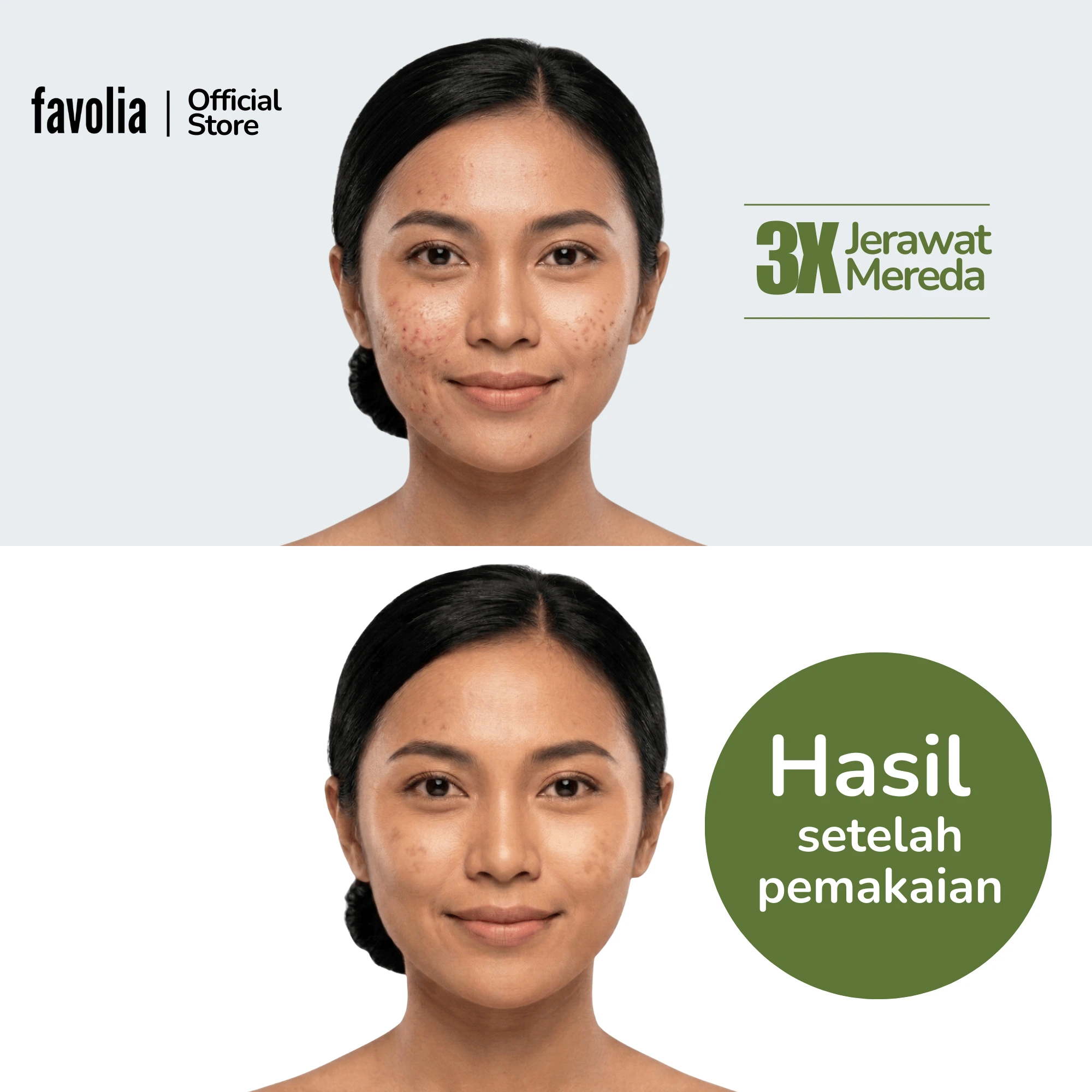 Perbandingan wajah sebelum dan sesudah pakai Mugwort Clay Mask, kulit tampak lebih bersih setelah pemakaian.