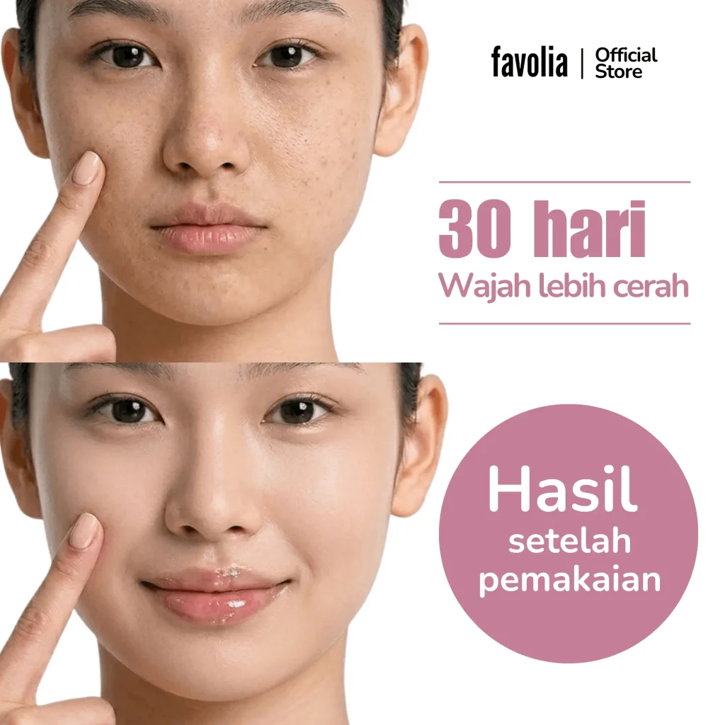 Before after kulit wajah setelah pakai Favolia Niacinamide Vit E Day Cream 30 hari